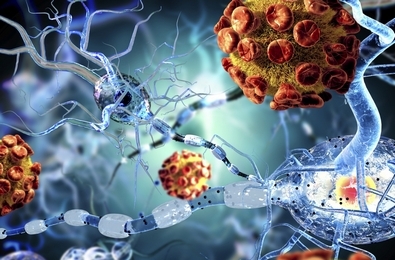 рассеянный склероз в Израиле